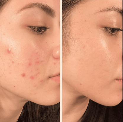 Kojic Acid арьс цайруулах саван